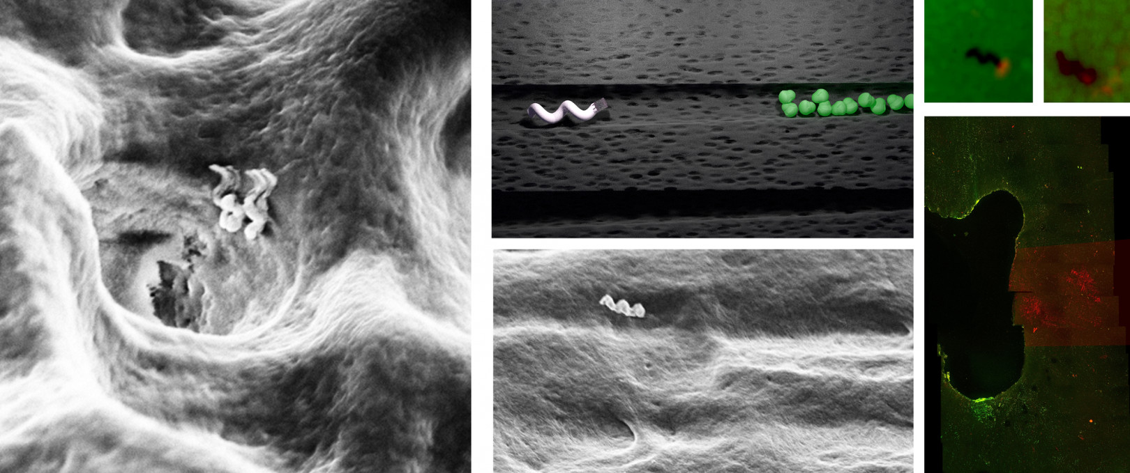 Obrazy i schematy przedstawiające nanoroboty poruszające się po kanalikach zębinowych w celu usunięcia bakterii / Theranautilus