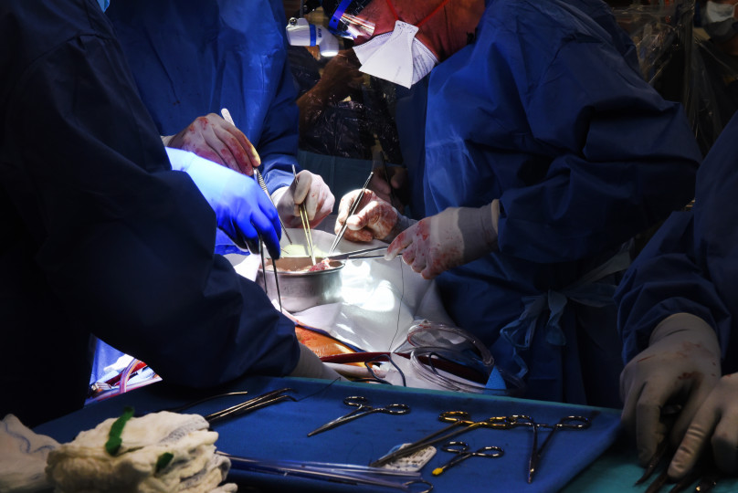 operacja ksenotransplantacji serca / Centrum Medyczne Uniwersytetu w Maryland / materiały prasowe 